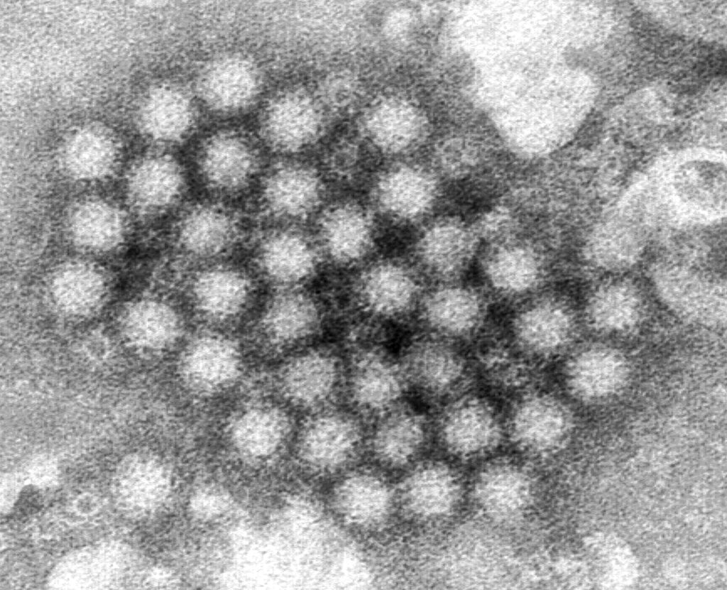 What is norovirus and why is it of concern this season in the US?